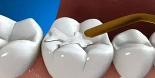 ������ô�� �����ЧԤ������